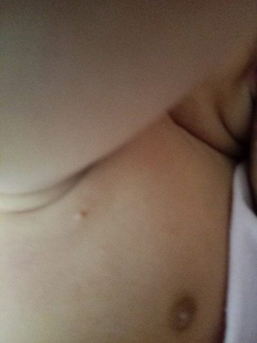 Biji mcm jerawat dkt ketiak baby