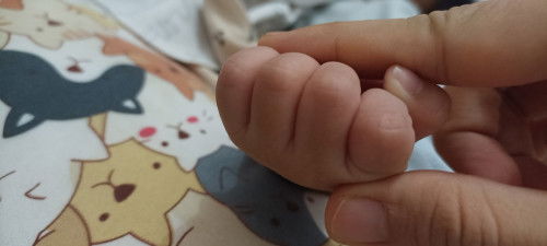 RS SPESIALIS BEDAH ANAK