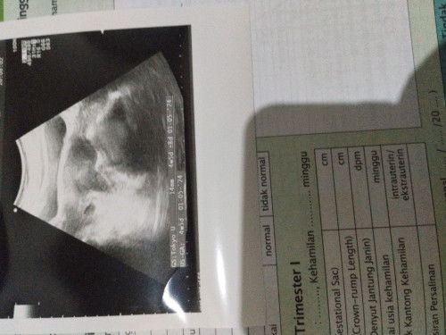 Seputar kehamilan