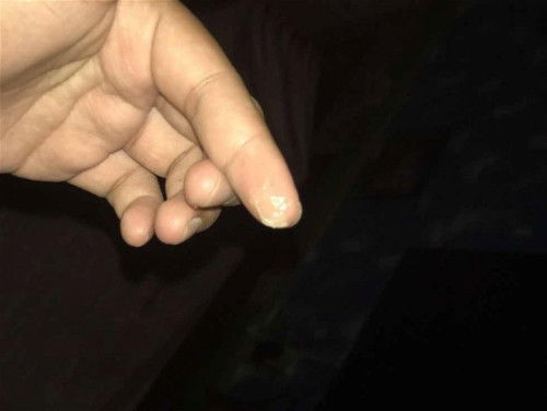 ขอถามแม่ๆทุกคนน่อยค่ะแบบนี้คือมูกใสใช่มั้ยค่ะ