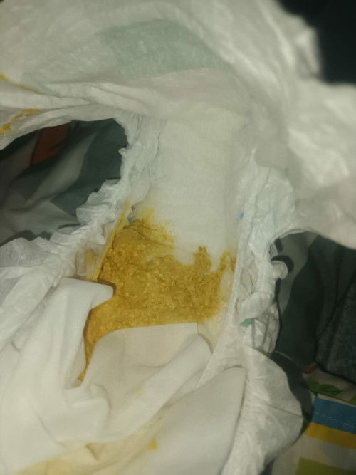 Poop bayi 2 bulan warnanya ga segolden biasanya