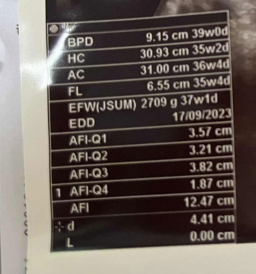 ปรึกษาขนาดศีรษะของลูกค่ะ