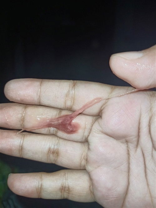 38สัปดาห์6วัน