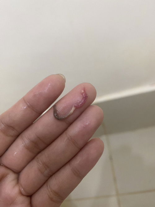 Possible miscarriage?