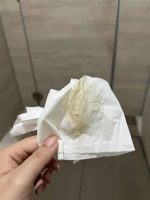 ตั้งครรภ์ 10 สัปดาห์