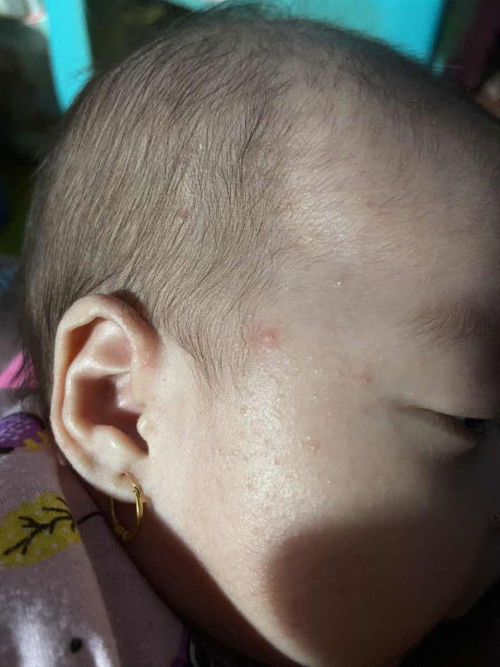 muka bayi merah merah