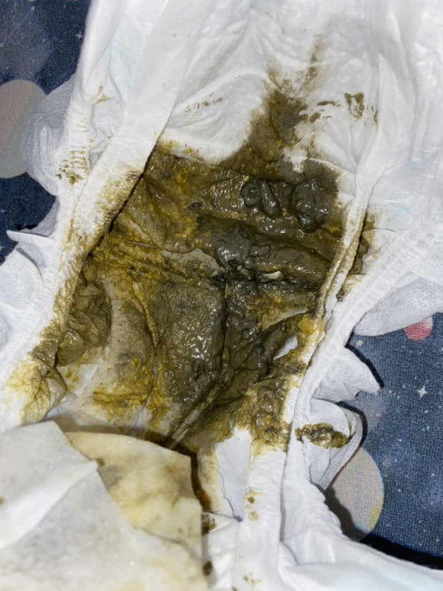 Poop ni baby turning 6 months in a few days ebf