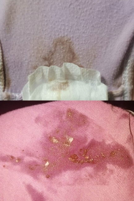 3cm for admission na, kahit no active signs of labor and hindi pa pumutok ang panubigan #ftm