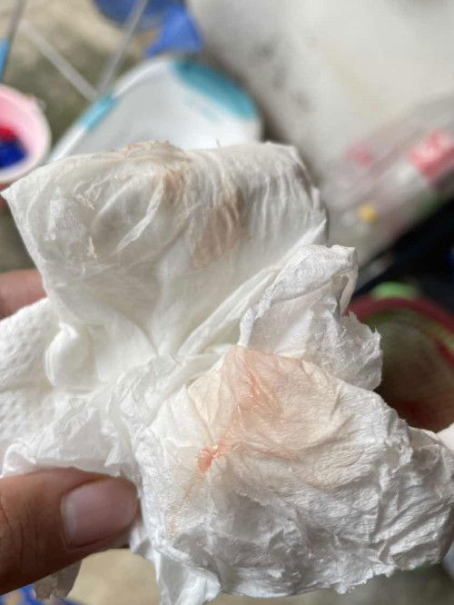 มีมูกเลือด แบบนี้ ควรไปหาหมอเลยมั้ยคะ