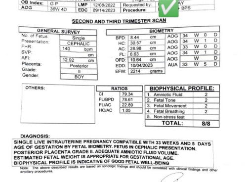 Weight ng baby sa Ultrasound