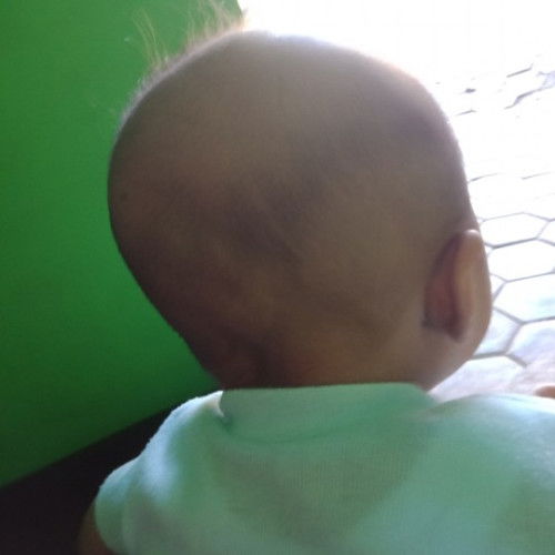 Tanya bun adakah yg kepala bayinya peyang.. Bisa bulat kembali gk ya bayi saya usia mau 4bln..??