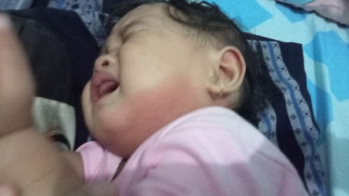 merah merah dan muncul bintil bintil