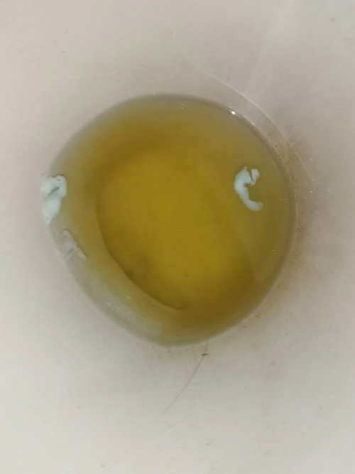 White discharge