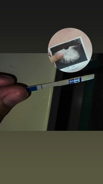 เลือดออกเลยตัดสอนใจไปตรวจครรภ์