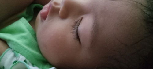 Bintik putih seperti panu