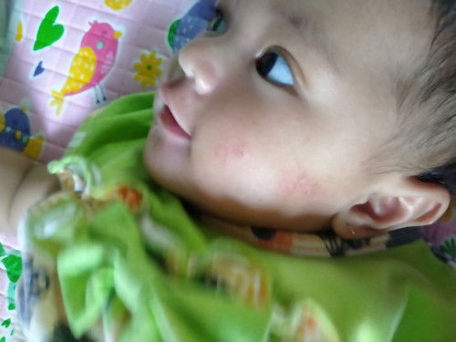 Pipi bayi merah kayak gini obatnya apa ya bun