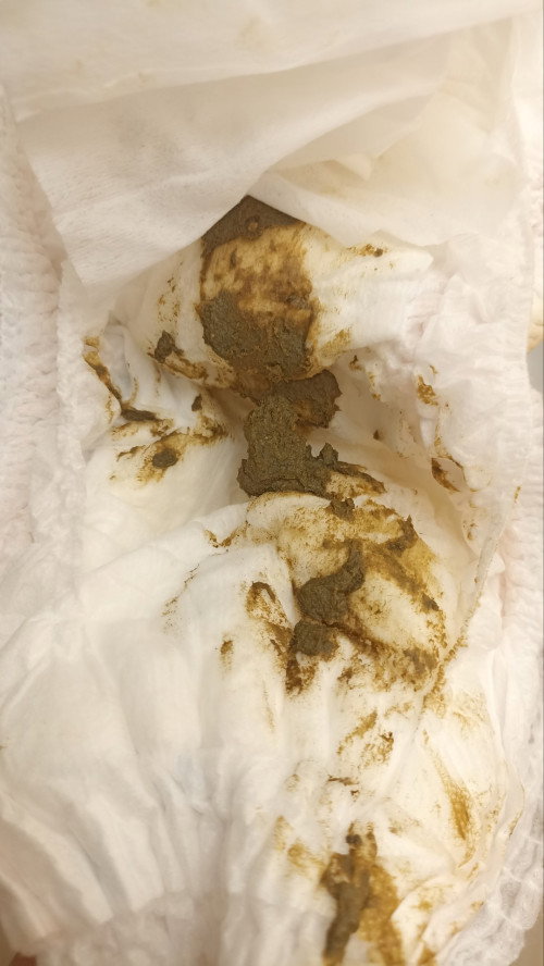 Bab hijau padat bau menyengat