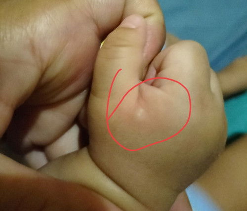 Apakah bayi sy alergi