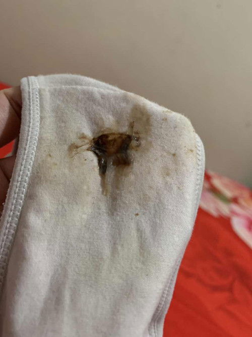 Maaf agak sensitif, keluar lendir dan keputihan warna coklat