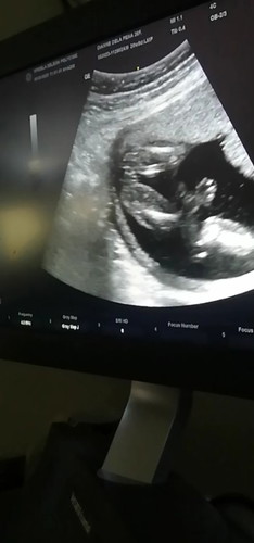 GENDER (BOY OR GIRL)