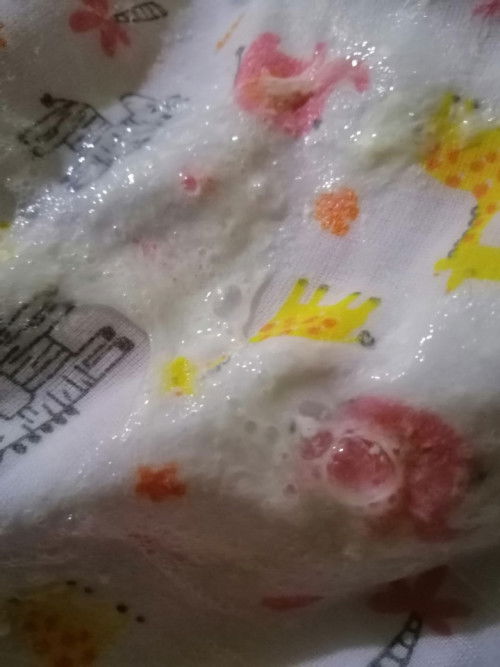 ขอคำปรึกษาจากแม่ๆหน่อยค่ะ