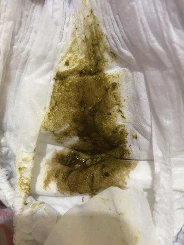 Poop of 3 months old