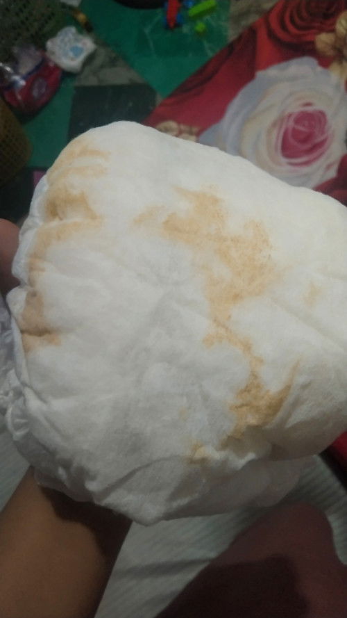 bercak orange di diapers anak