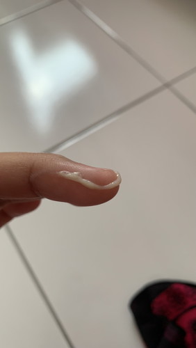 keputihan normal ke tak