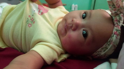 Bun ada yg tau ini merah merah dipipi anak ku apa termasuk eksim?