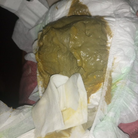 Green poop makapal 6 months