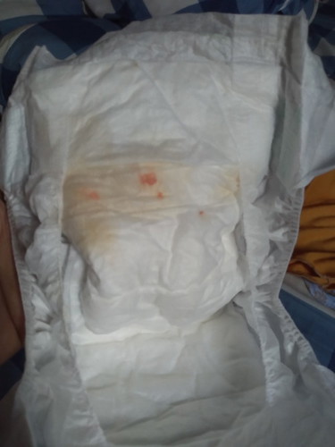 Pipis bayi newborn ada bercak orange, usia bayi baru 3 hari bun. Ada yg pernah mengalami?
