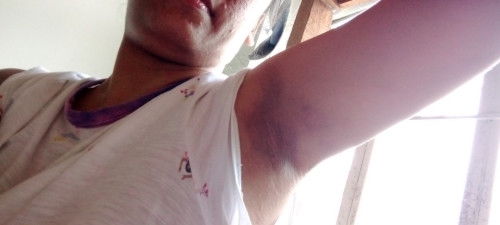 Pasantabe lang po ma nga mommy Tanong ko lang ano po kaya Yun sa kiliki ko sobrakati at ano gamoDito