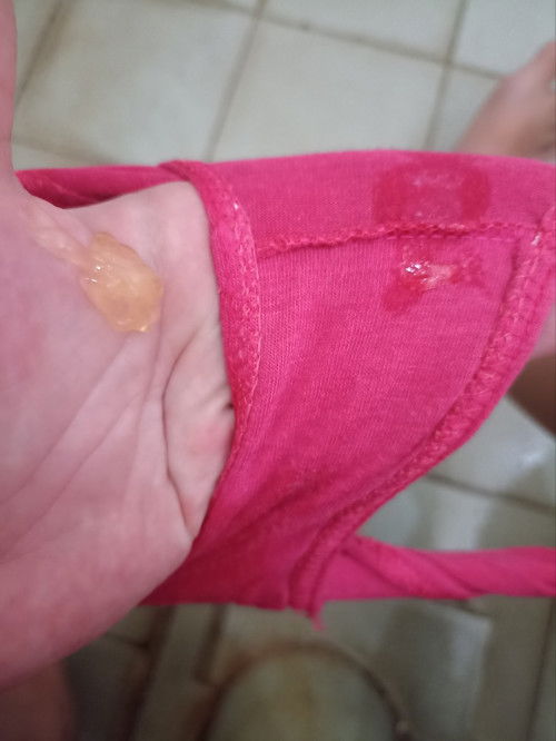 Mucus plug or Primerose?