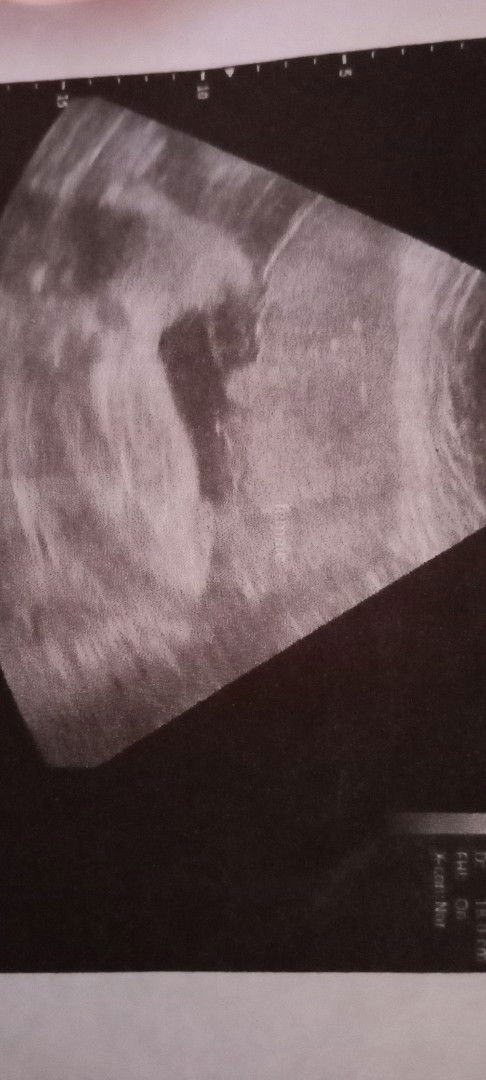 ช่วยดูเพศให้ทีค่ะ