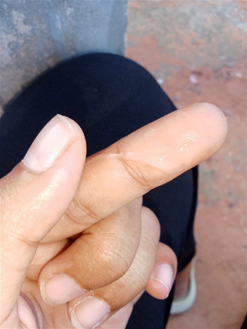 ท้อง39สัปดาห์3วัน😍