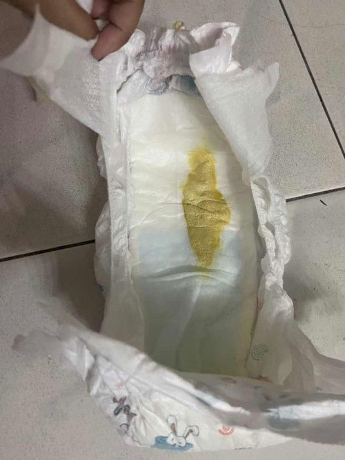 Baby 6 bulan tak berak mcm biasa