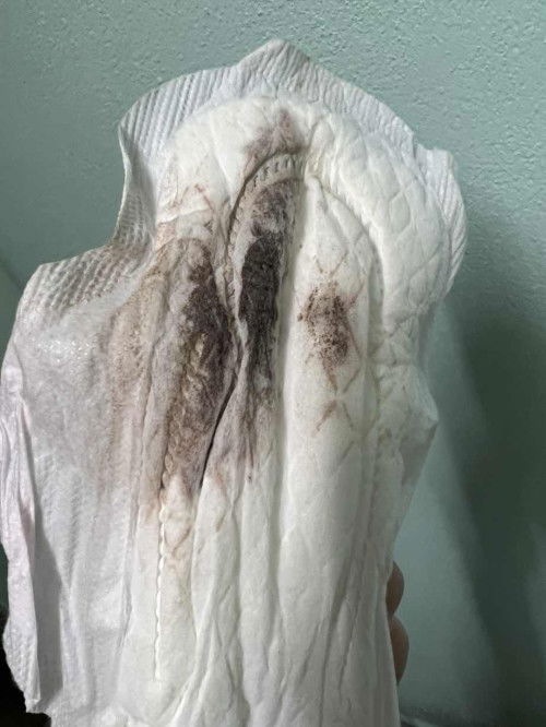 น้ำคาวปลา หรือประจำเดือน