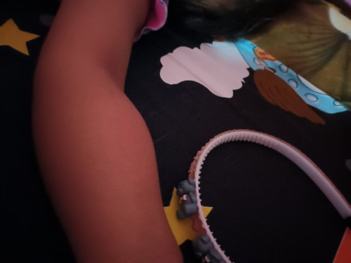 น้องเป็นตุ่มแข็งบวมแล้วน้องเกา ตุ่มนี้เกิดจากอะไรอันตรายมั้ยคะ