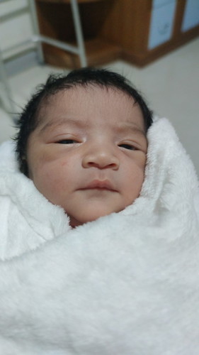 คลอดแล้วครับ 38W2D