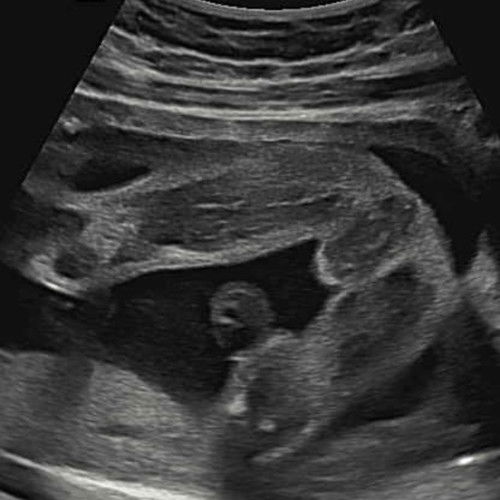 น้องเป็นผู้หญิงรึเปล่าคะเเม่ๆ