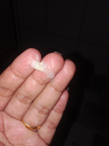 ขออนุญาตถามแม่ๆ แบบนี้ปกติมั้ยค่ะ