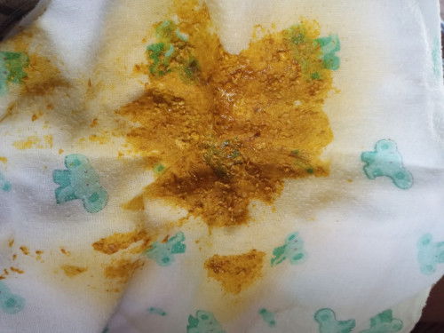 น้องอาย23วัน ถ่ายเเล้วมีมูกผิดปกติรึป่าวค่ะ น้องกินนมแม่เสริมนมผง 
(นมตราหมีสูตร1)