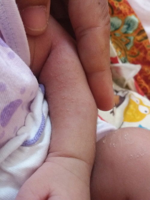 อยากทราบว่ามีน้องบ้านไหนที่เพิ่งคลอดได้ไม่ถึงสองวีคแล้วขึ้นแบบนี้บ้างค่ะ.