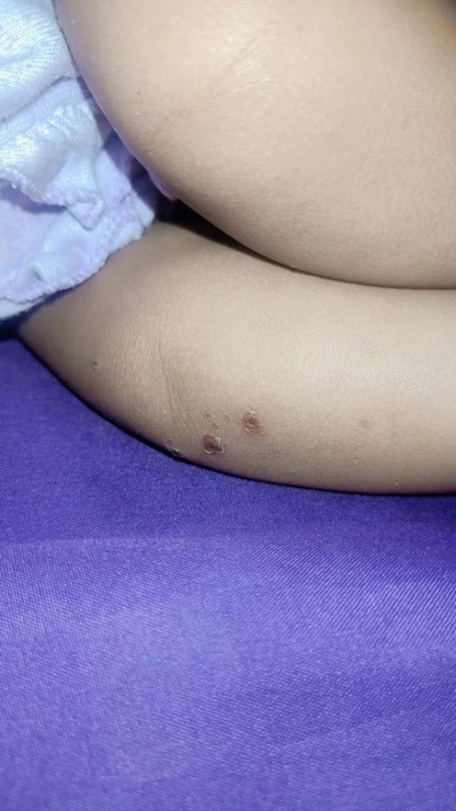 Bintik-bintik di badan