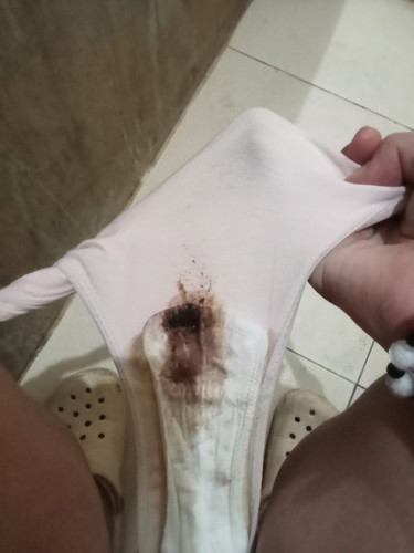 dugo ba o brown discharge?