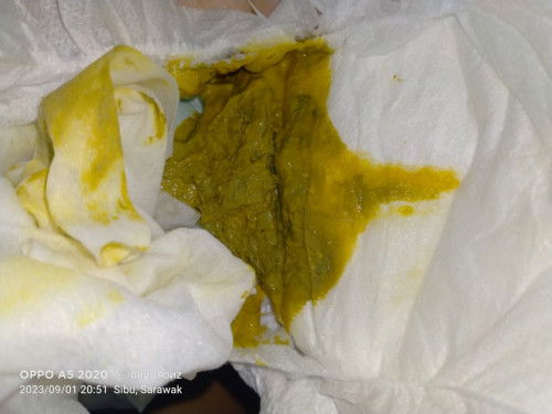 Minum susu lacgtn wrna najis memng mcm ni kh?