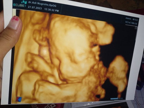 USIA KANDUNGAN 23 MINGGU