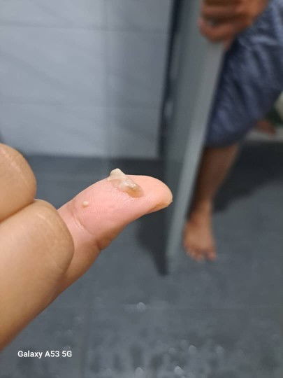 Keputihan biasa atau spotting,dn tegang perut sgt