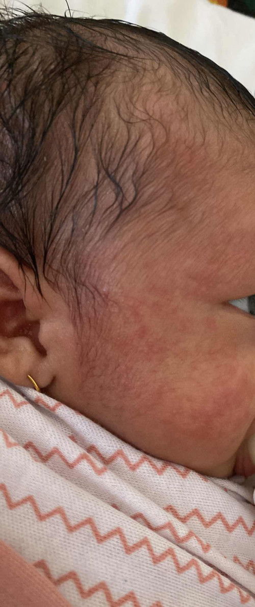 Solusinya gimna ya bun ada yg pernah ngalami ga ?