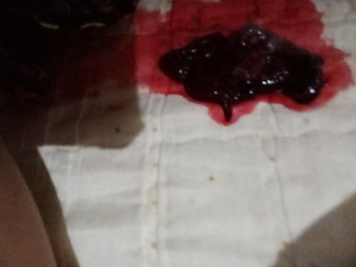 Second misscarrage paano ko malabanan